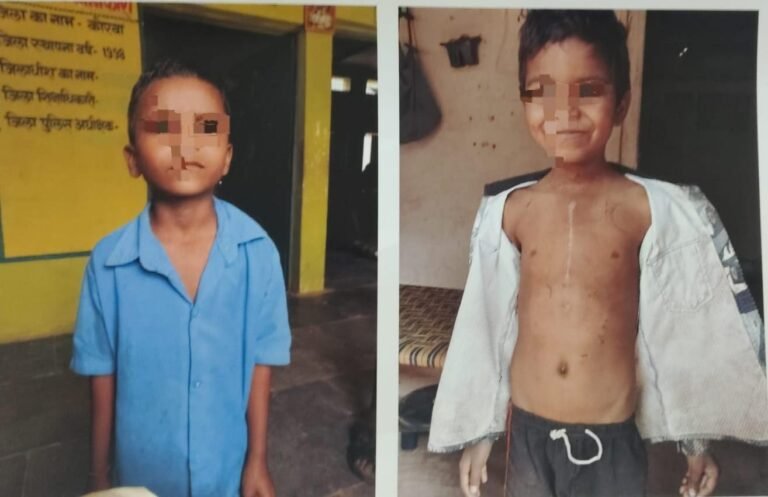 चिरायु योजना बनी जीवनदायिनी: नन्हे लक्ष्मीनारायण को मिला नया जीवन